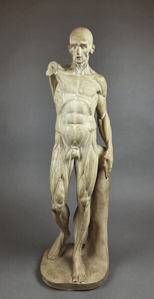 Flayed plaster cast, early 20th century
